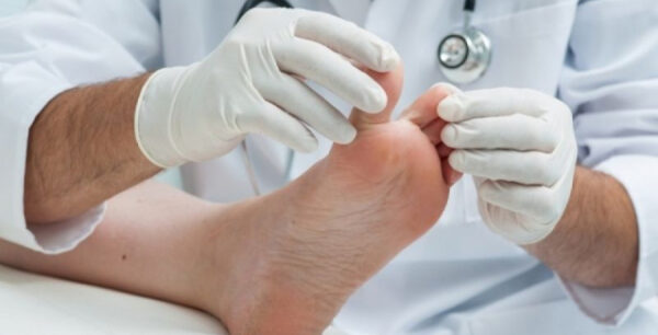 Απομάκρυνε τους μύκητες από τα πόδια σου