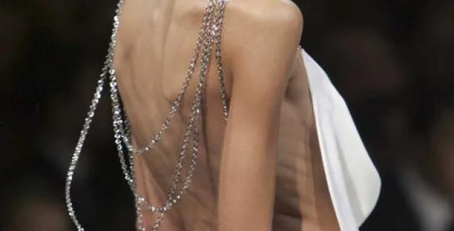 Πειραματική ηλεκτροθεραπεία στον εγκέφαλο κατά της νευρικής ανορεξίας