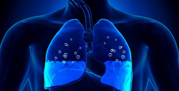 Τα μικρά συμπτώματα που δείχνουν συσσώρευση υγρού στον πνεύμονα