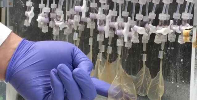 Μετέτρεψαν ένα φύλλο από σπανάκι σε λειτουργικό καρδιακό ιστό