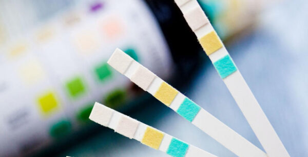 Γυναικείες ουρολοιμώξεις: Τα 6 βασικά συμπτώματα και πώς θα ανακουφιστείτε