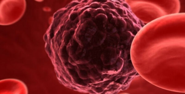 Ισραηλινοί επιστήμονες ανακάλυψαν μέθοδο αυτοκαταστροφής των καρκινικών κυττάρων