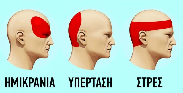 Πως θα απαλλαγείτε από τους πονοκεφάλους σε 5 λεπτά χωρίς χάπια
