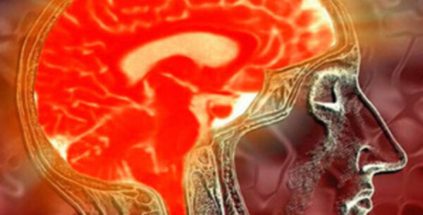 Η ανεργία αυξάνει τον κίνδυνο εγκεφαλικού