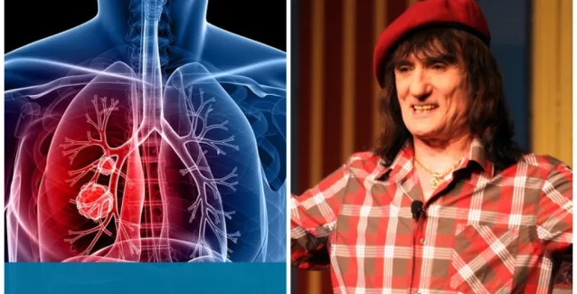 Πέθανε από καρκίνο που ξεκίνησε στον πνεύμονα ο Στάθης Ψάλτης – Πώς μπορεί να συμβεί και σε όσους ΔΕΝ καπνίζουν