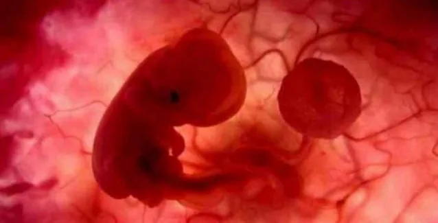 Δυσμορφίες σε 4.100 έμβρυα από αντιεπιληπτικό φάρμακο