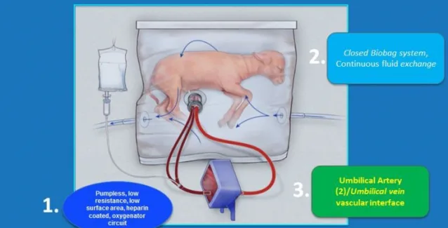 Εξωτερική τεχνητή μήτρα για τα υπερβολικά πρόωρα μωρά