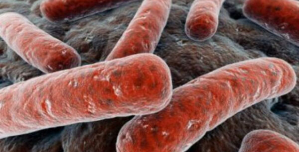 Σύστημα τεχνητής νοημοσύνης κάνει διαγνώσεις φυματίωσης