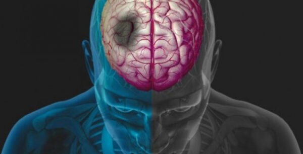 Αυτά είναι τα 5 συμπτώματα εγκεφαλικού και αφορούν όλες τις ηλικίες