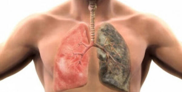 Αυτές είναι οι τροφές που καθαρίζουν τους πνεύμονες από τη νικοτίνη