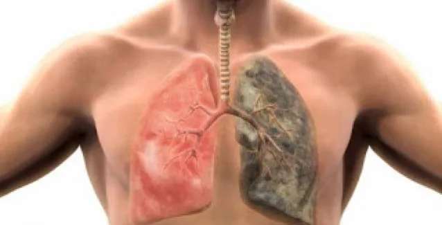 Αυτές είναι οι τροφές που καθαρίζουν τους πνεύμονες από τη νικοτίνη