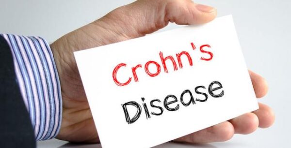 Όλα όσα πρέπει να γνωρίζετε για τη νόσο του Crohn