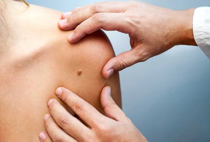 Έρευνα: Πόσοι Ευρωπαίοι έχουν τουλάχιστον ένα δερματολογικό πρόβλημα