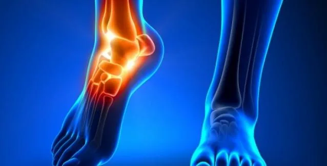 Ουρικό οξύ: Τι να τρώτε και τι να αποφεύγετε για να μειωθούν τα συμπτώματα