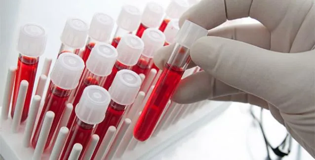 Το σπάνιο “μαγικό φάρμακο” από ανθρώπινο αίμα, σώζει ζωές