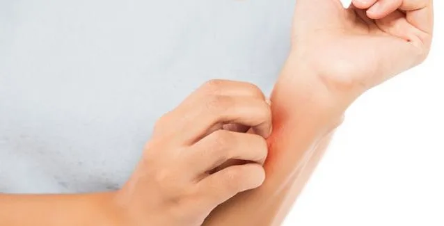 Ροδόχρους πιτυρίαση: Συμπτώματα και τρόποι αντιμετώπισης