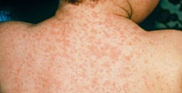 Ιλαρά: Η εικόνα της Ελλάδας