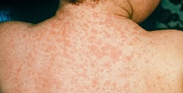 Ιλαρά: Η εικόνα της Ελλάδας