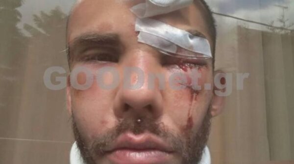 Ξυλοδαρμός φοιτητή στο Ρέθυμνο – Ελεύθεροι αφέθηκαν οι δυο συλληφθέντες