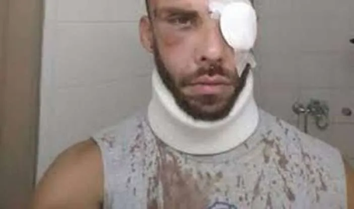 Ξεσπά ο πατέρας φοιτητή, θύμα άγριου ξυλοδαρμού: Γιατί μας σκοτώνετε τα παιδιά μας;