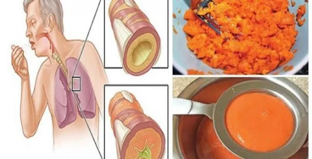 Αυτή είναι η αρχαία συνταγή που θεραπεύει τον βήχα