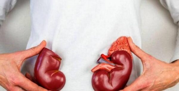 Πέτρες στα νεφρά: Οι πέντε χρυσοί κανόνες πρόληψης