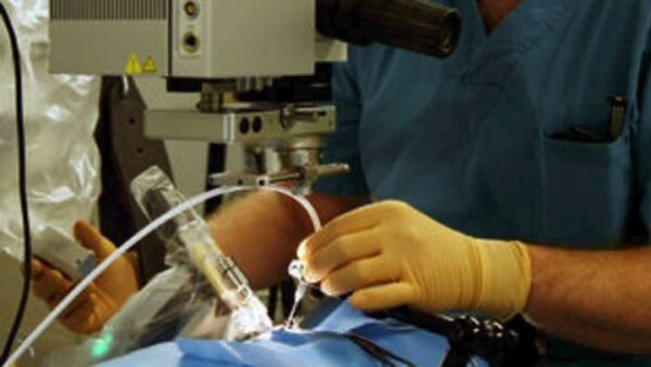 Αντιμετώπιση του κερατόκωνου με σταγόνες βιταμίνης Β12