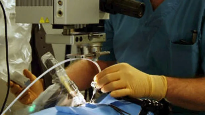 Αντιμετώπιση του κερατόκωνου με σταγόνες βιταμίνης Β12