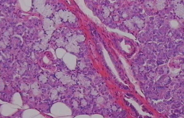 Μίνι σιελογόνο αδένα δημιούργησαν στο εργαστήριο Ιάπωνες επιστήμονες