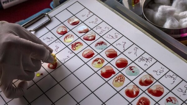 Πειραματικό τεστ αίματος ανιχνεύει οποιονδήποτε καρκίνο μέσα σε 10 λεπτά