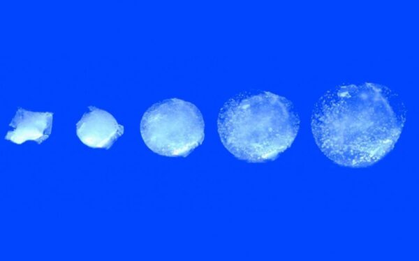 Eρευνητές του ΜΙΤ δημιούργησαν το πρώτο έξυπνο χάπι «κατάσκοπο»