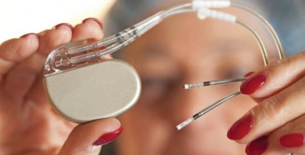 Βηματοδότης χωρίς ηλεκτρόδια τοποθετήθηκε για πρώτη φορά στο Ιπποκράτειο σε ασθενή