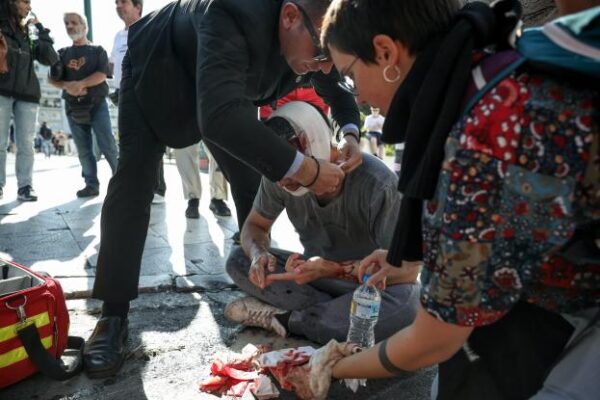 Φοιτητής τραυματίστηκε σοβαρά στο κεφάλι από κρότου-λάμψης στο φοιτητικό συλλαλητήριο