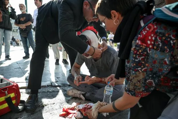 Φοιτητής τραυματίστηκε σοβαρά στο κεφάλι από κρότου-λάμψης στο φοιτητικό συλλαλητήριο