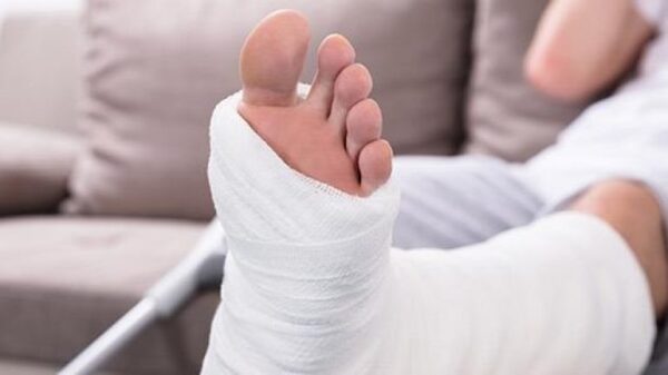 Μεγαλύτερος ο κίνδυνος κατάγματος για όσους έχουν έκζεμα