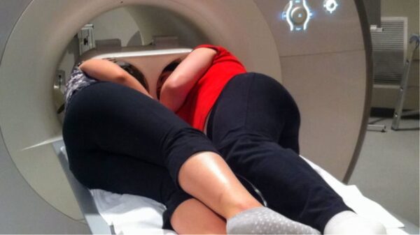 Νέα μέθοδος μαγνητικής απεικόνισης του εγκεφάλου ανά ζεύγη