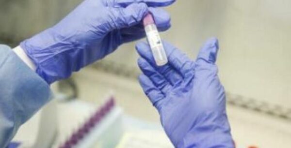 Θεσσαλονίκη – κορονοϊός: Κινητές μονάδες του ΕΟΔΥ από σήμερα έξω από εφημερεύοντα νοσοκομεία