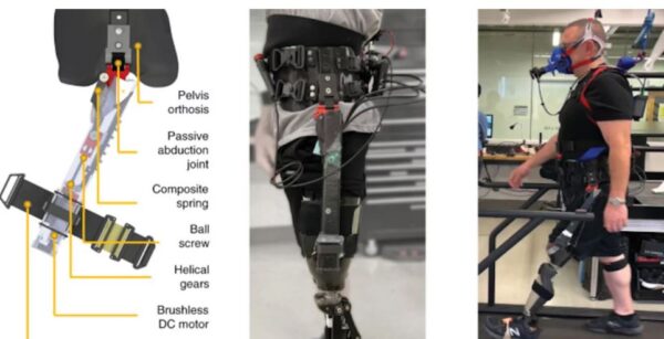 «Εξυπνος» εξωσκελετός βελτιώνει τη βάδιση ασθενών με ακρωτηριασμό πάνω από το γόνατο