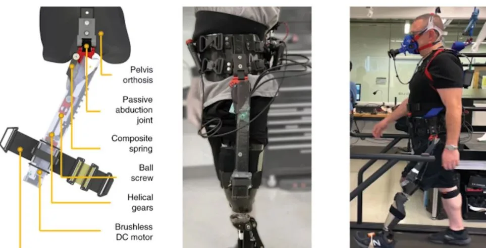 «Εξυπνος» εξωσκελετός βελτιώνει τη βάδιση ασθενών με ακρωτηριασμό πάνω από το γόνατο