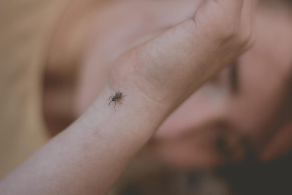 Τσίμπημα εντόμου: Πότε γίνεται απειλή για τη ζωή – Τα συμπτώματα που δεν πρέπει να αγνοήσετε