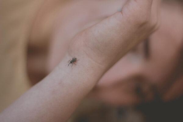 Τσίμπημα εντόμου: Πότε γίνεται απειλή για τη ζωή – Τα συμπτώματα που δεν πρέπει να αγνοήσετε