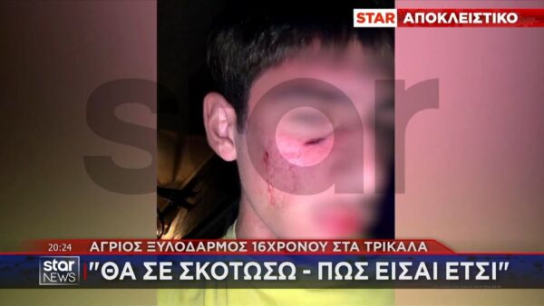 Άγριος ξυλοδαρμός 16χρονου από συνομήλικό του – Οι απειλές και το χρονικό